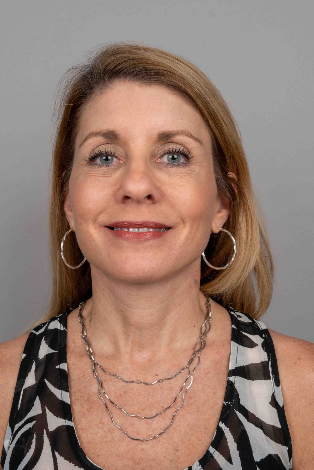 Facelift Before & After