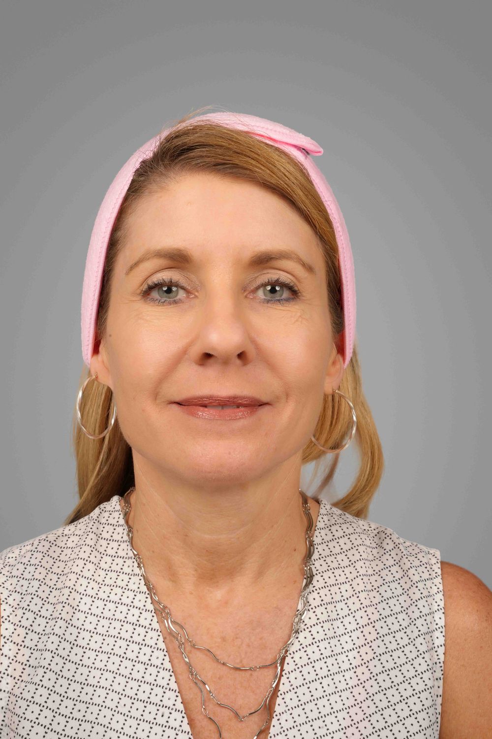 Facelift Before & After