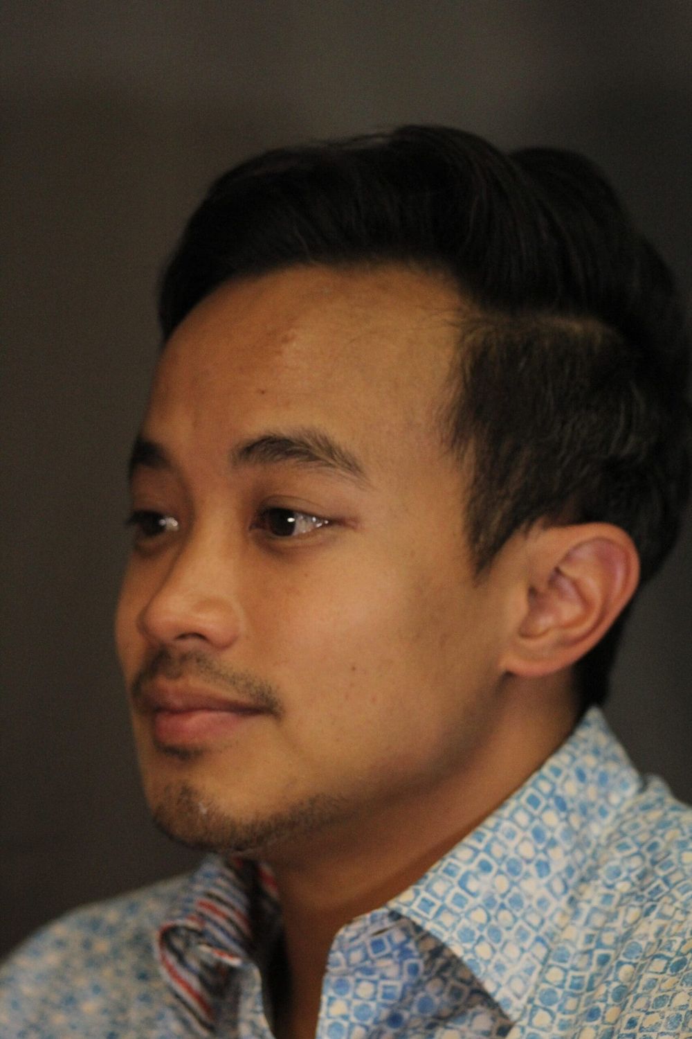 Chin Augmentation Before & After