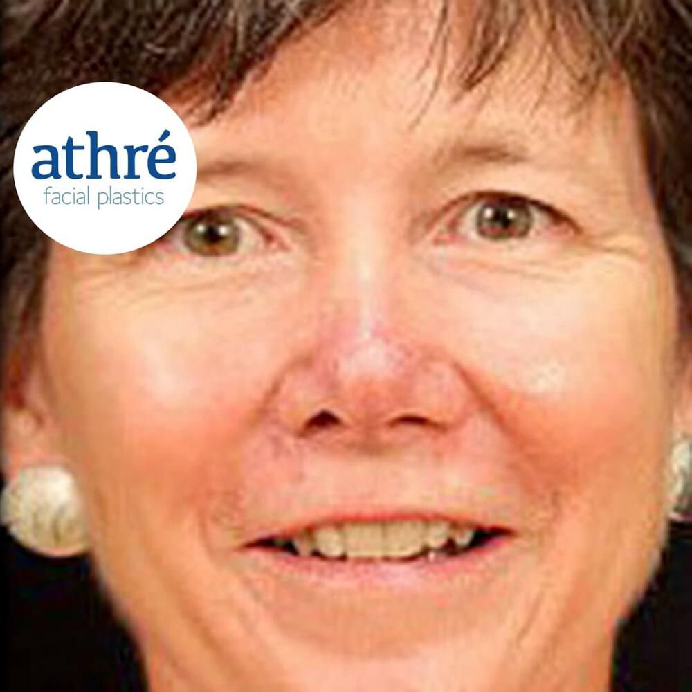 Skin Cancer Before & After