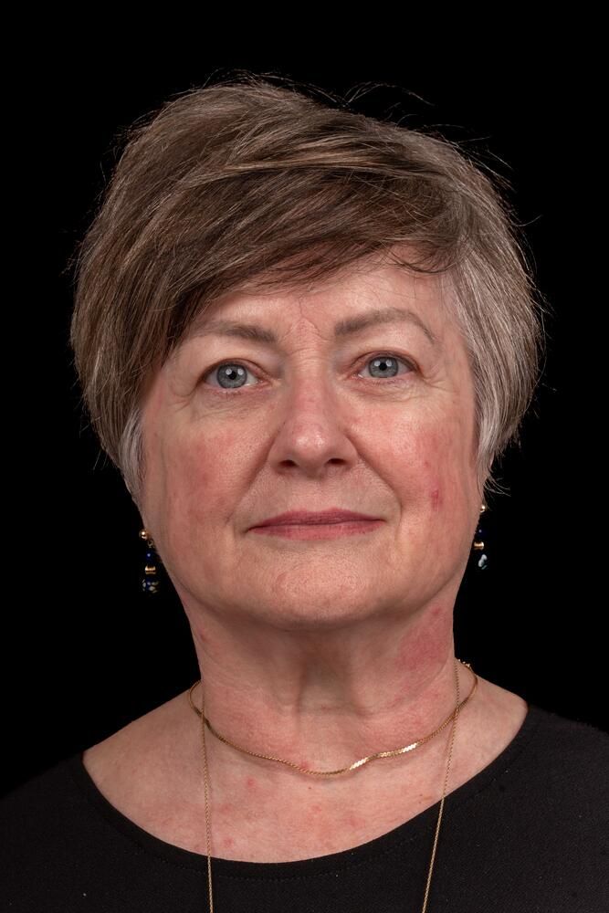 Brow Lift Before & After